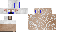 Texture for aglayan creeper