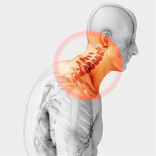 Texture for Pain in the lower part of the neck